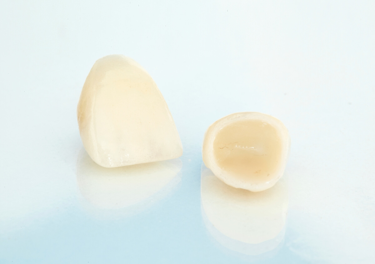 Will a dental crown effectively restore a chipped or cracked tooth?