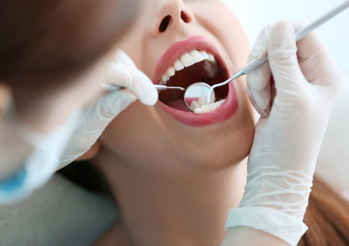 What Happens During Teeth Cleaning at Rugby Dental Arts?